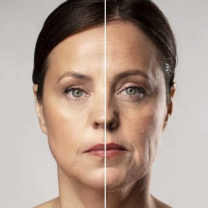 FaceLift