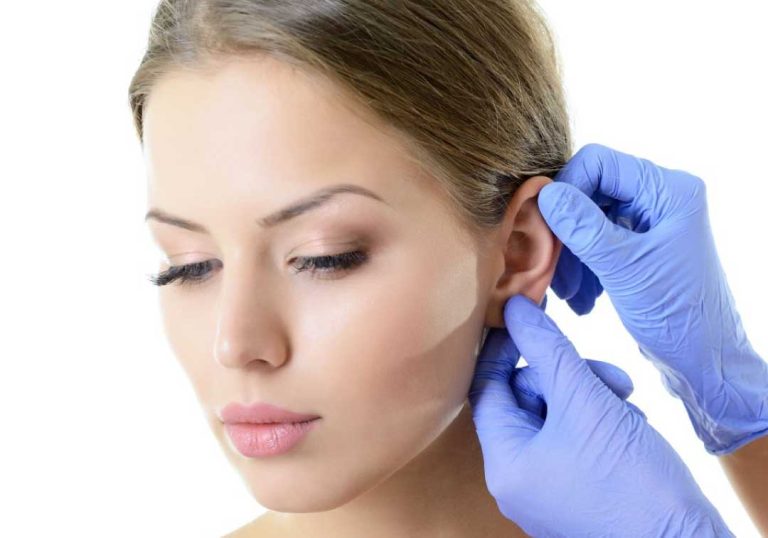 Otoplasty