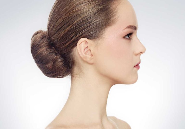 Rhinoplasty