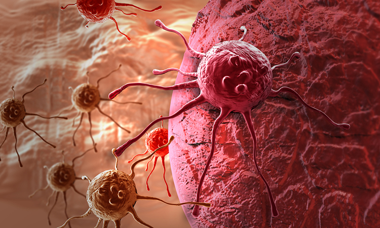 Dr. Amin Alam: Leading Oncology Surgeon for Cancer Recovery Cancer Treatment - Dr. Amin Alam Oncology Surgeon in Lahore Pakistan