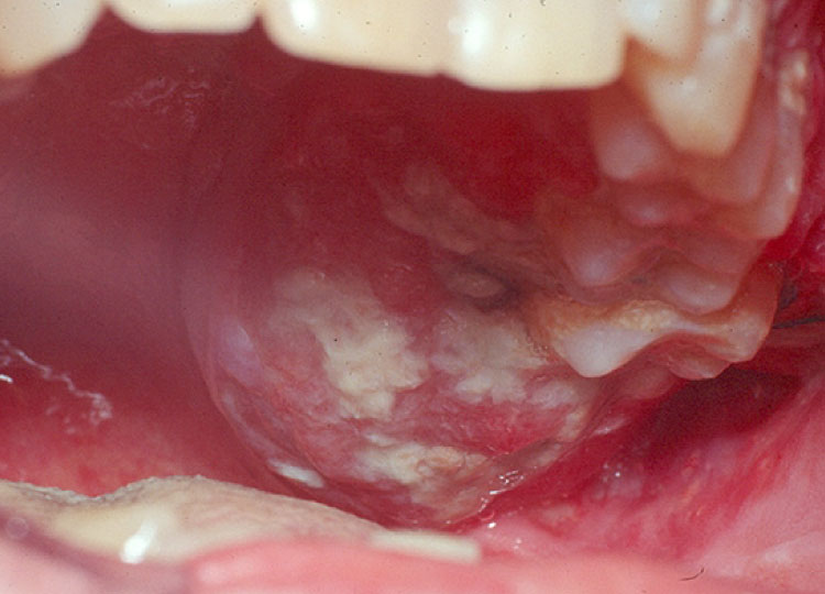 Dr. Amin Alam: Leading Oncology Surgeon for Cancer Recovery oral cancer treatment in Lahore Pakistan - oncology surgeon Dr. Amin Alam