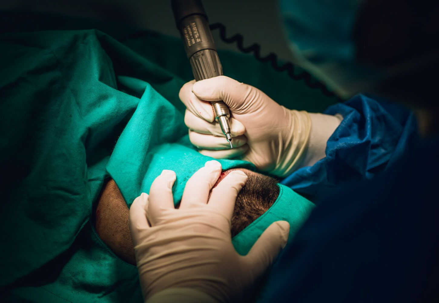 Hair Transplant Services by Dr. Amin Alam – Restore Your Confidence FUE Hair Transplant in Pakistan by Dr Amin Alam