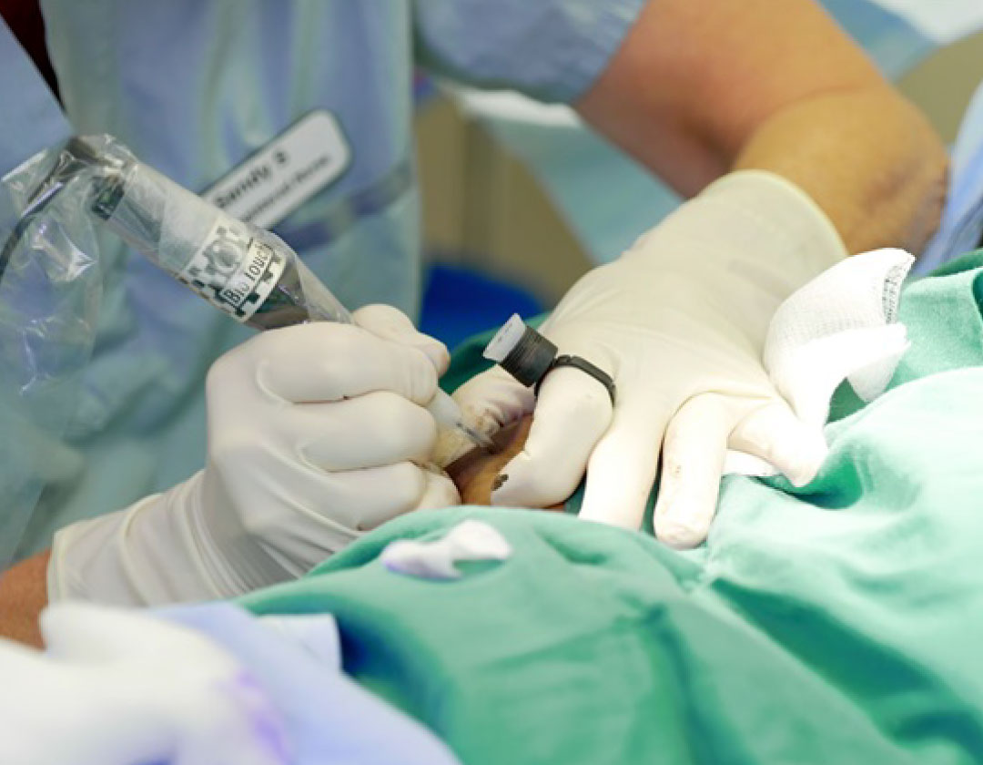 Areola and Nipple treatments by dr. Amin Alam plastic Surgeon Lahore