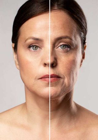 facelift portrait