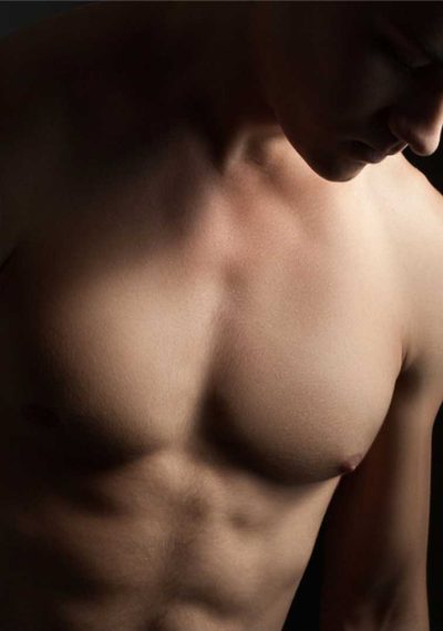 Gynecomastia