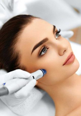 microneedlingP