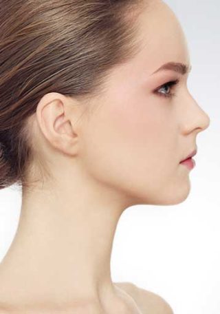 rhinoplasty